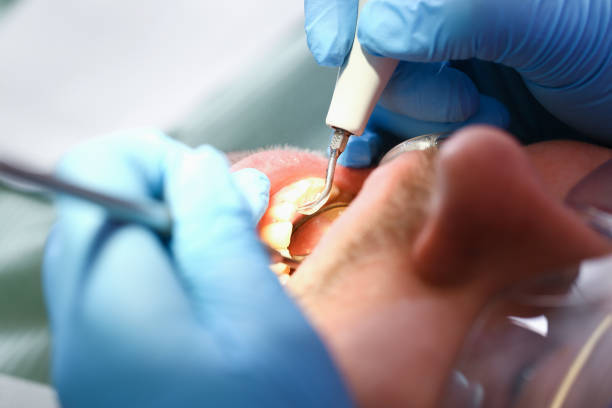 Best Emergency Broken Tooth Repair in Amory, MS