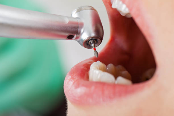 Best Walk-In Emergency Dentist in Amory, MS